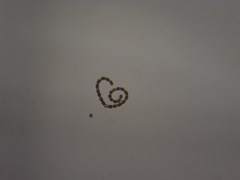 Dolichospermum lemmermannii