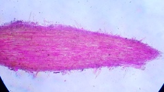 Pseudohiatula irrorata