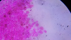 Pseudohiatula irrorata