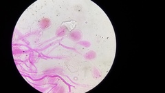 Pseudohiatula irrorata