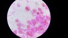 Pseudohiatula irrorata