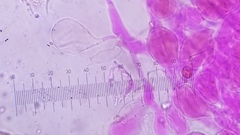 Pseudohiatula irrorata