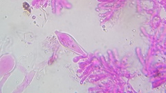 Pseudohiatula irrorata