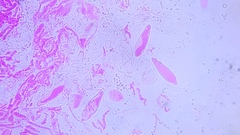 Pseudohiatula irrorata