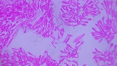 Pseudohiatula irrorata