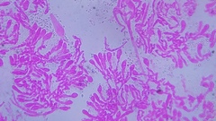 Pseudohiatula irrorata