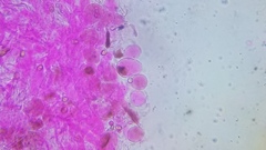 Pseudohiatula irrorata