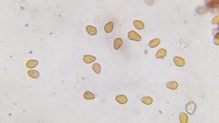 Psilocybe moseri