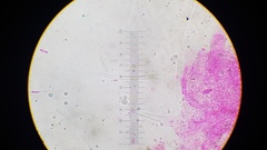 Gloiocephala
