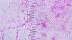 Gloiocephala
