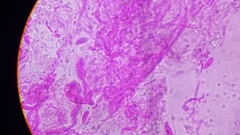Gloiocephala