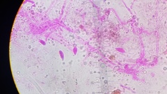 Gloiocephala