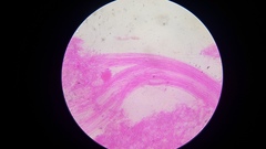 Gloiocephala
