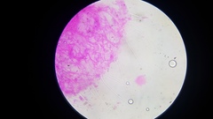 Gloiocephala