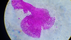 Gloiocephala