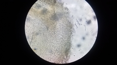 Pseudobaeospora stevensii