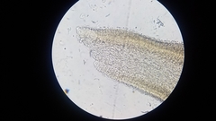 Pseudobaeospora stevensii