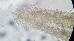 Pseudobaeospora stevensii