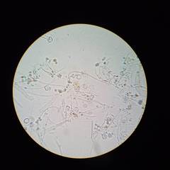 Pulvinula archeri