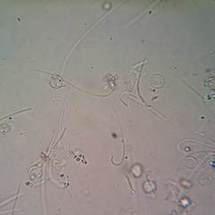 Pulvinula archeri