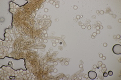 Arcyria stipata