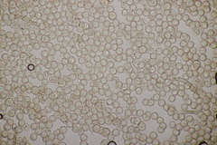 Arcyria stipata