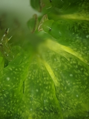 Neumichtis
