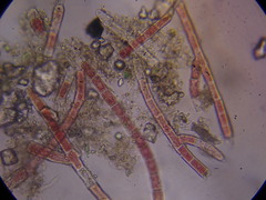 Rhodochorton purpureum