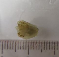 Bivalvia