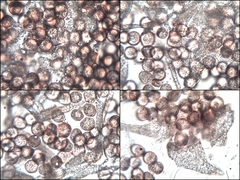 Physarum polycephalum