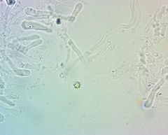 Clitocybe amarescens