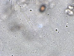 Cortinarius saturninus