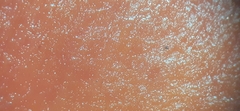 Coccineae