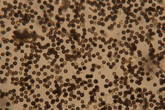 Aspergillus niger
