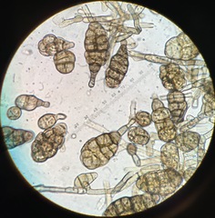 Alternaria