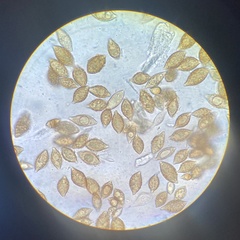 Descomyces