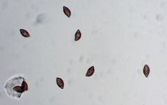 Cortinarius collinitus