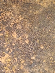 Stachybotryaceae