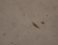 Amphileptus procerus