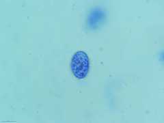 Scutellinia colensoi