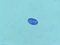 Scutellinia colensoi