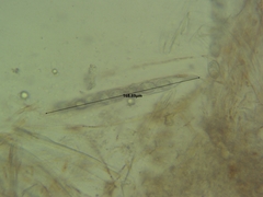 Scutellinia colensoi