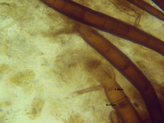 Scutellinia colensoi