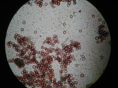 Physarum crateriforme