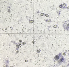 Melanoleuca communis