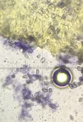 Melanoleuca communis