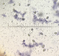 Melanoleuca communis