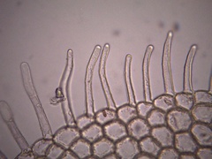Metzgeria leptoneura