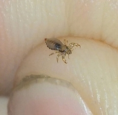 Pediculus humanus