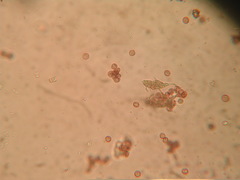 Physarum globuliferum